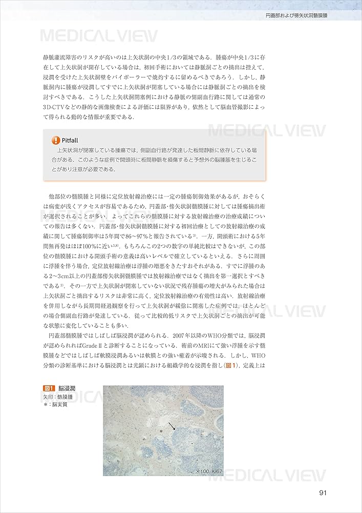 脳腫瘍外科経験したい手術16 スタンダードからアドバンス 8120rZ9SULL._UF1000,1000_QL80_.jpg